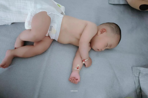 黔西六个月宝宝眼睛散光